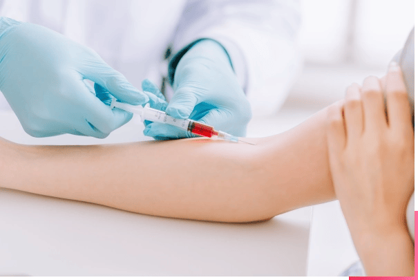 자가혈을 사용한 피부 세포 재생