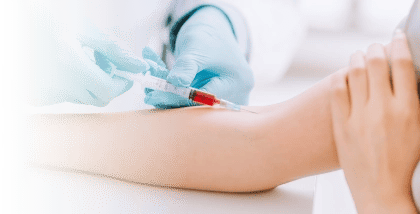 자가혈을 사용한 피부 세포 재생