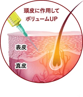 頭皮に作用してボリュームUP 表皮 真皮