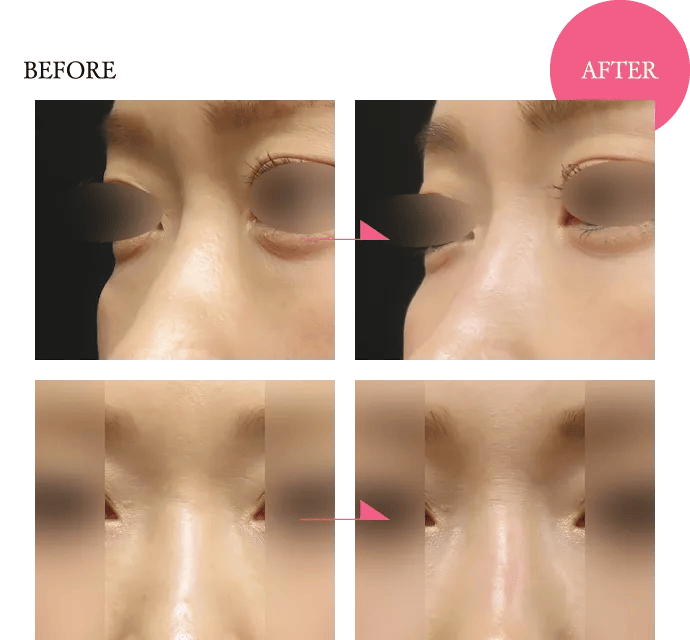 症例写真