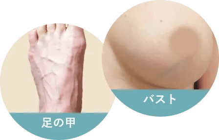足の甲・バスト