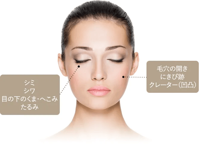 ダーマペンの適応部位