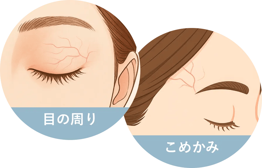 目の周り・こめかみ
