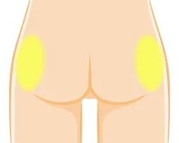 側面のへこみ