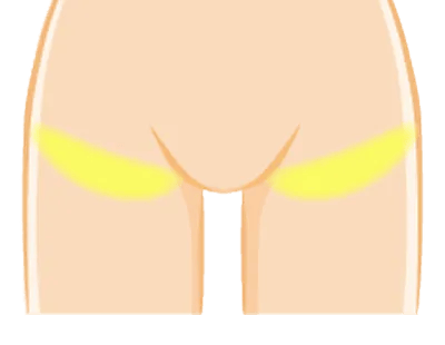 足のつけ根