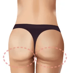 下にボリューム・年齢による下垂