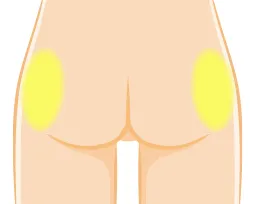 側面のへこみ
