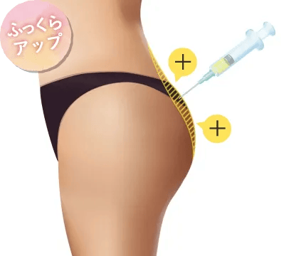PRP注射/理想のボディライン形成