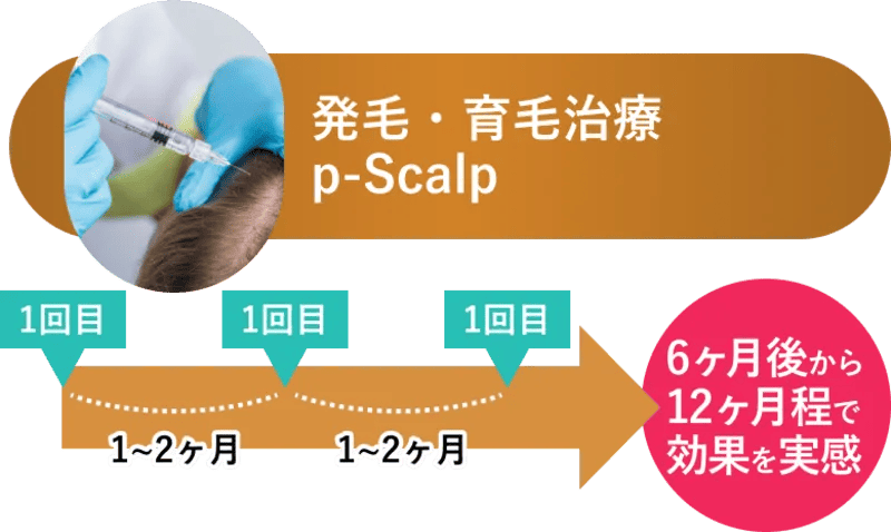 必要な回数が違う