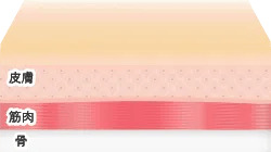 ボトックスによる治療