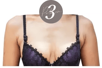 やせてデコルテの骨が目立つ