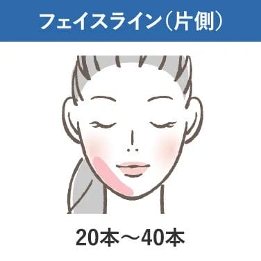 フェイスライン(片側)