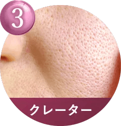 こんなお肌のお悩みに適しています