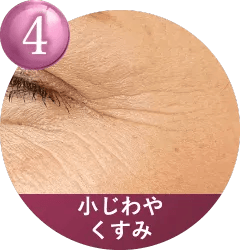 こんなお肌のお悩みに適しています