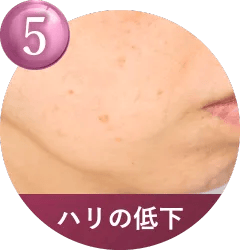 こんなお肌のお悩みに適しています