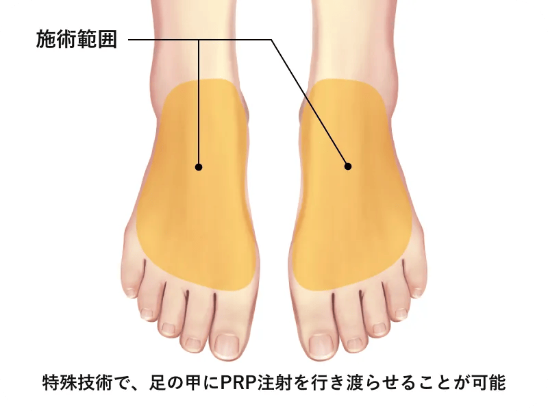 治療のメカニズム