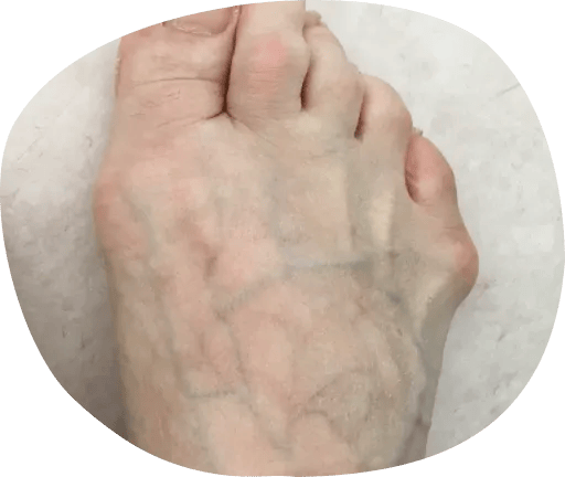 足の血管が目立つ