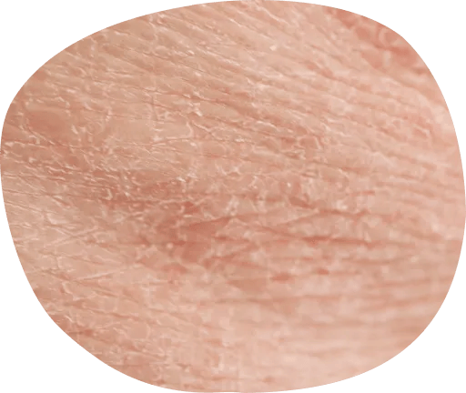 肌が乾燥している