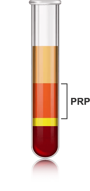 PRP