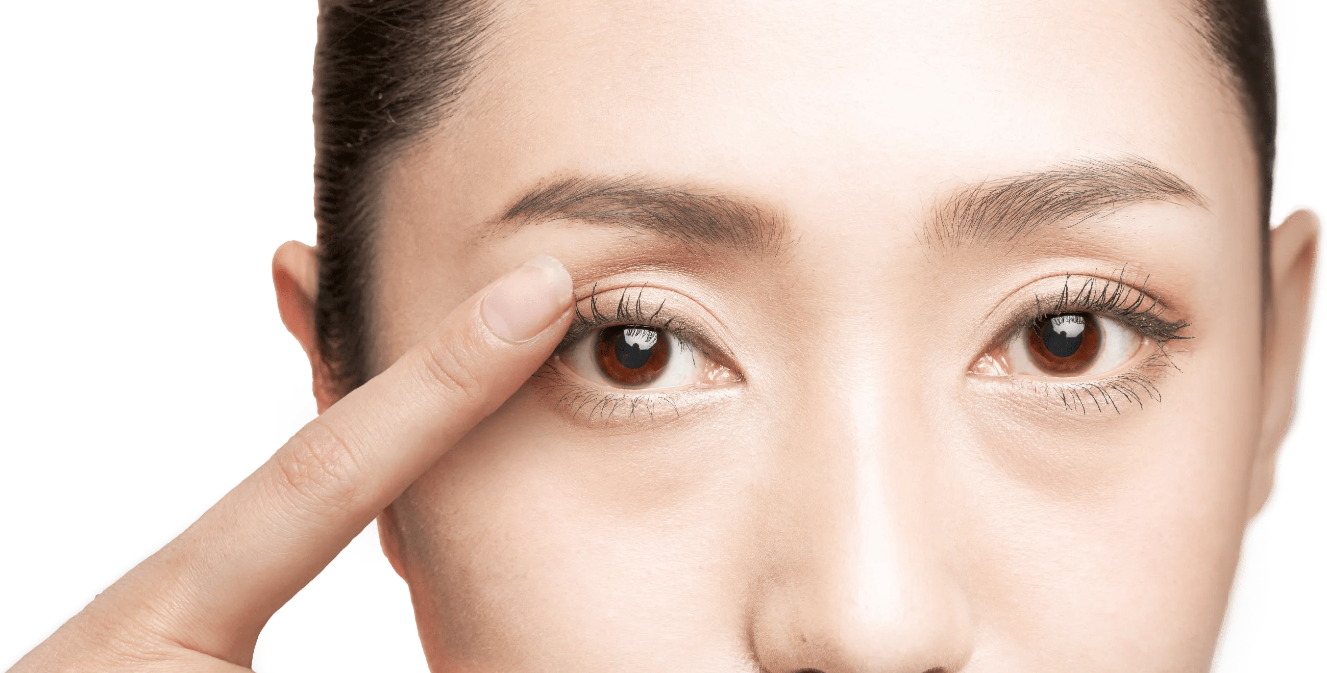 上まぶたのくぼみ改善