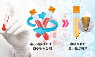 PRPがとにかく濃い！