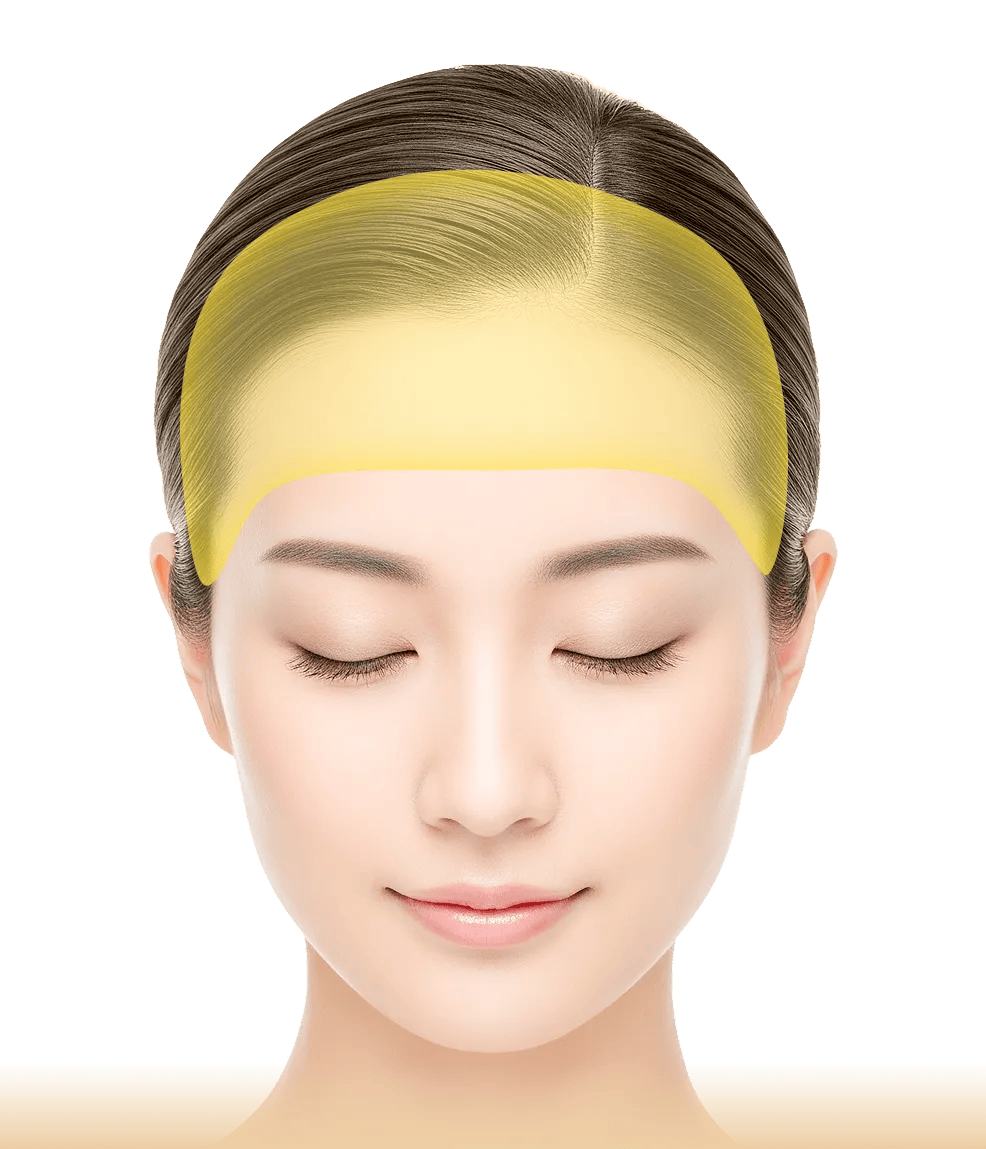 PRP注射だからできる重要なポイント