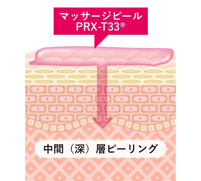 ●皮膚を剥離しないで古い角質を除去●表皮ターンオーバーの促進●強力美白