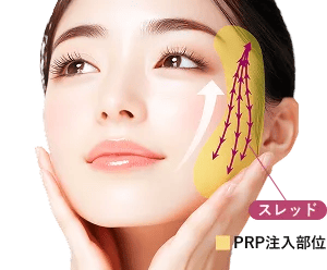 リフトアップ肌再生効果