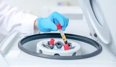 独自のPRP作製技術