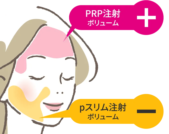 PRP注射施術部位：額、こめかみ