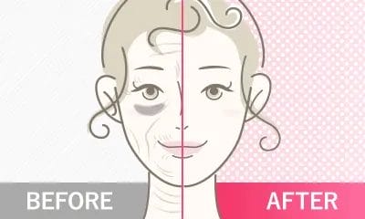 色素沈着も改善！