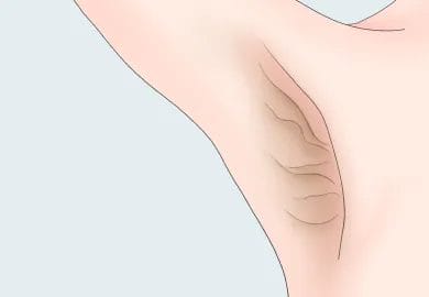 シワ・たるみの原因