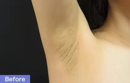 深いシワがあり、全体的に黒ずんでいる状態