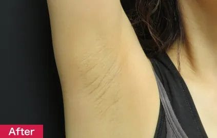 肌再生と美白効果により皮膚がふっくら黒ずみも解消