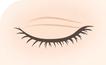 以前の奥二重の線が目立つ