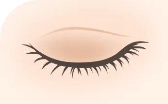 炎症性色素沈着