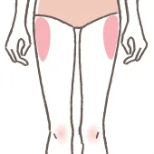 外もも＜大転子＞（両側）の施術イメージ