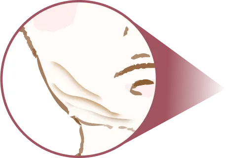 脂肪の取りすぎ、取り残し