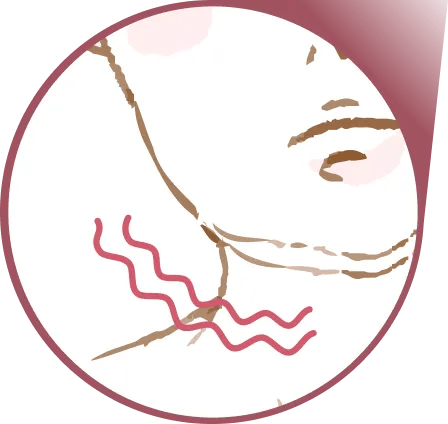 皮膚のたるみ、ひきつれ