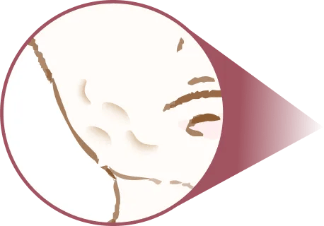 表面のデコボコ