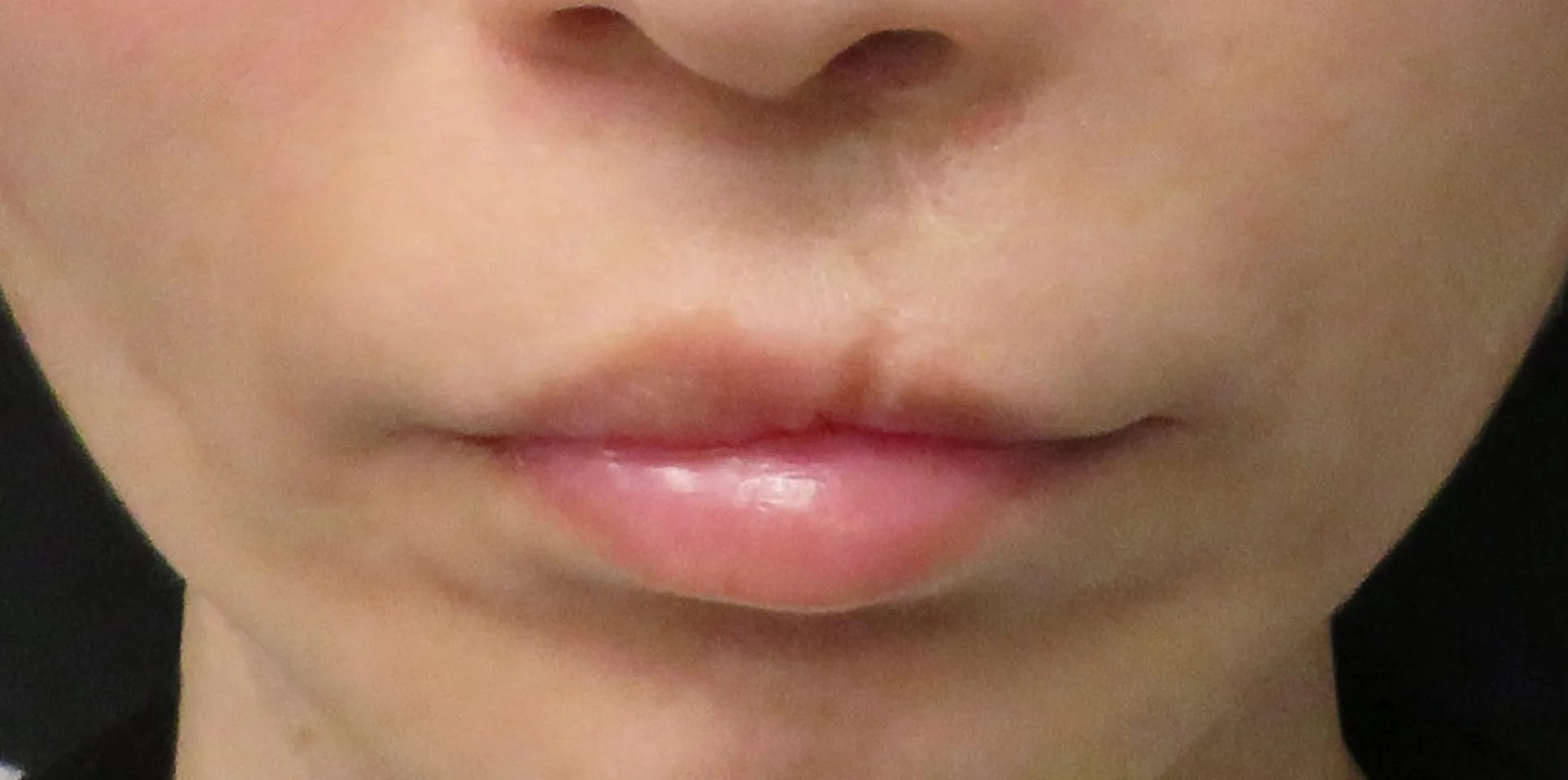 before:女性の唇