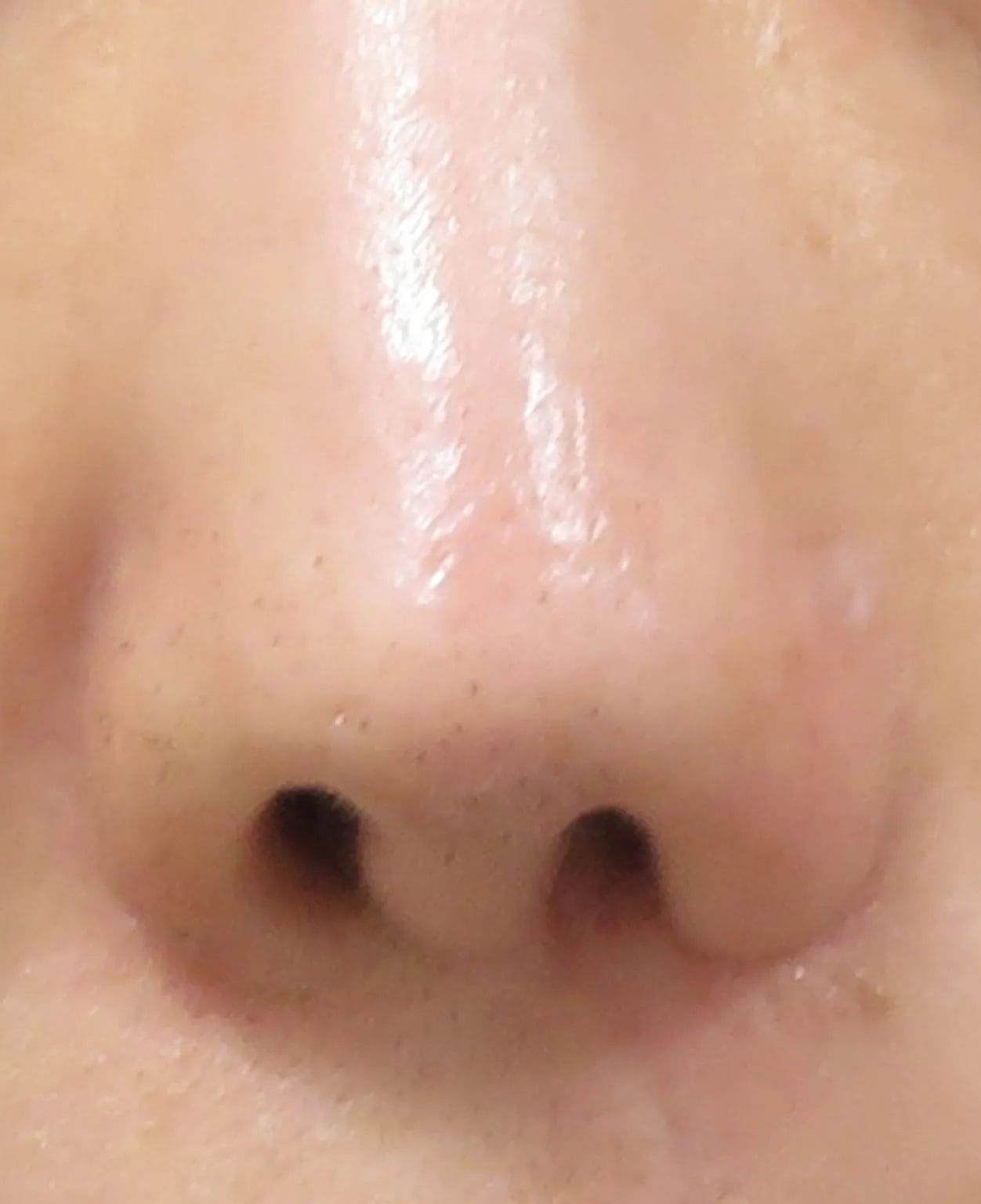 after:女性の鼻