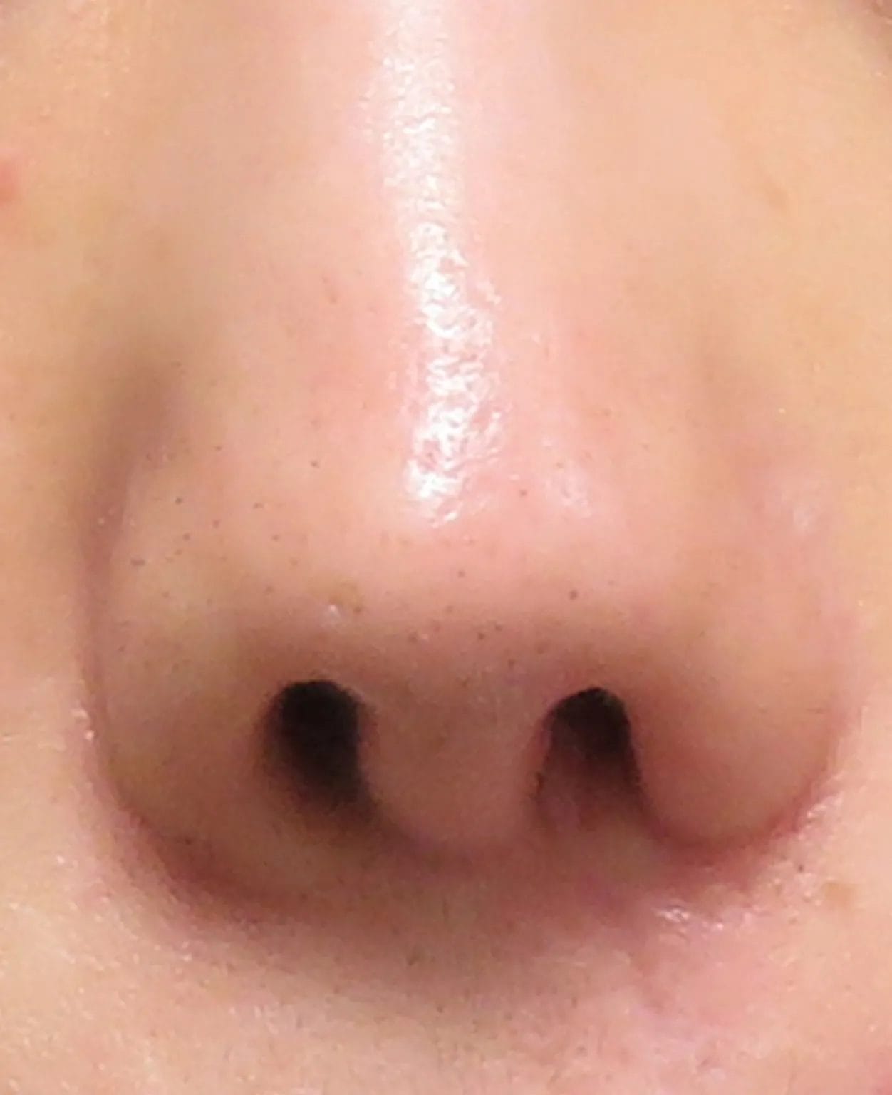 before:女性の鼻