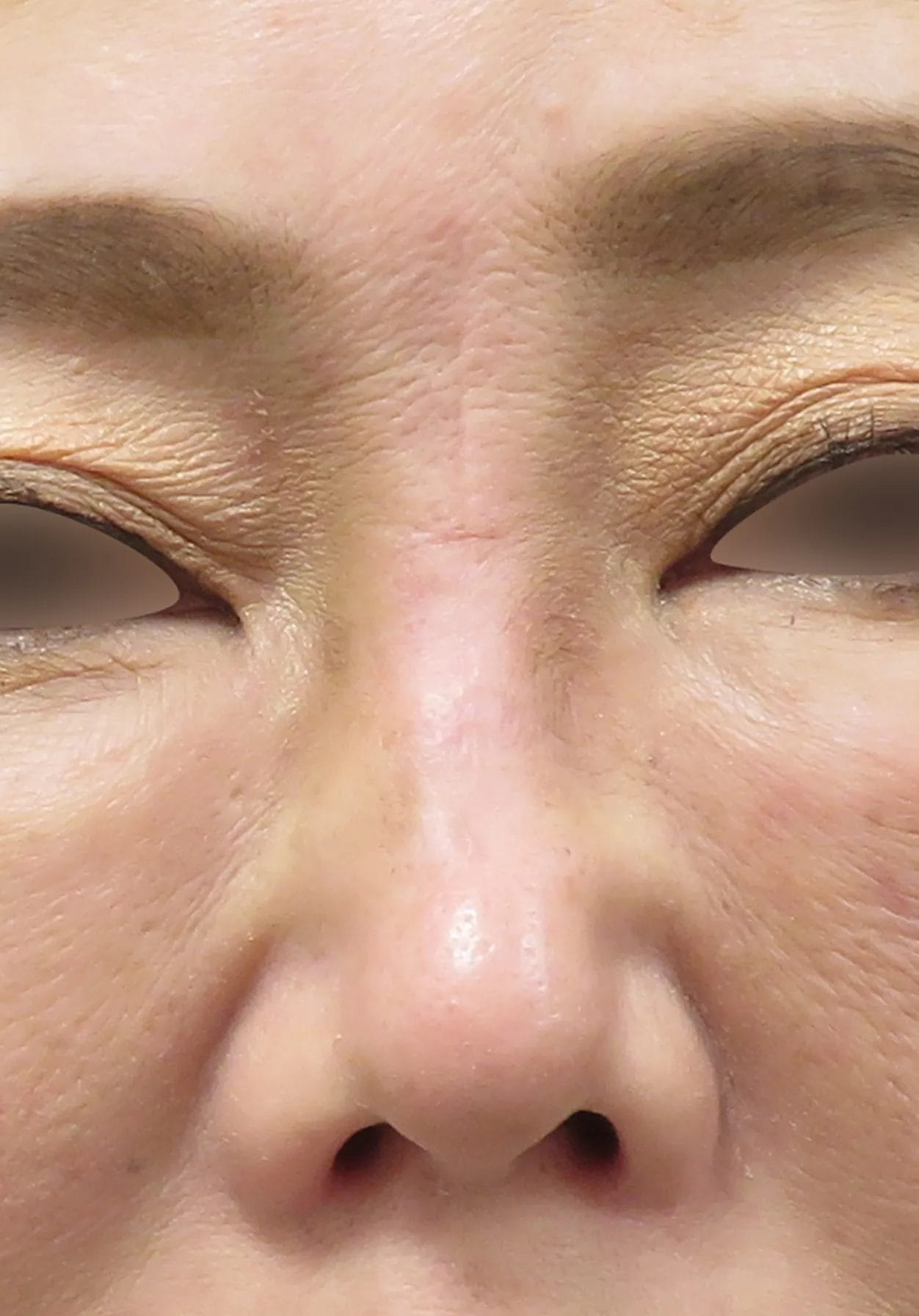 after:女性の顔