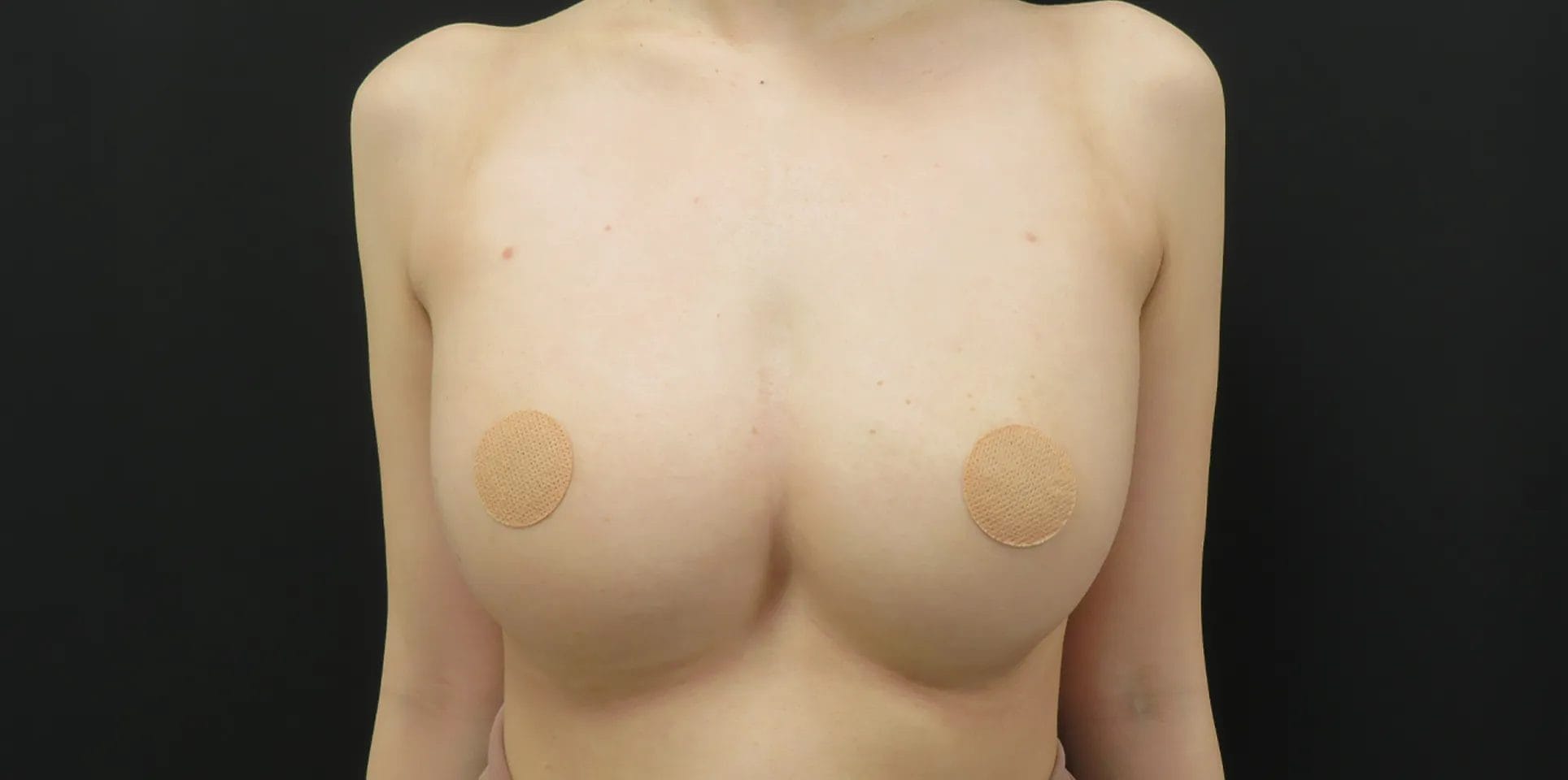 after:女性の胸