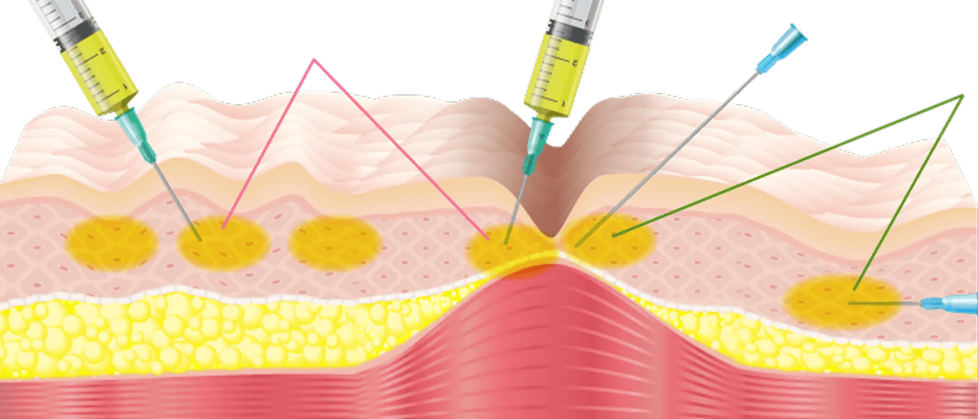 肌が整うように再生をデザイン