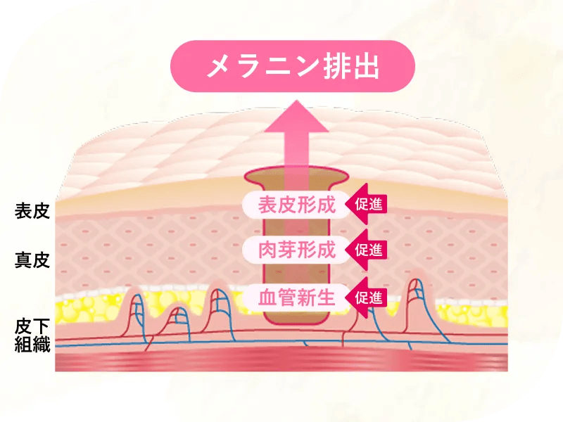 血流を取り戻し色素沈着軽減