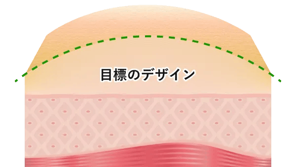 目標のデザイン