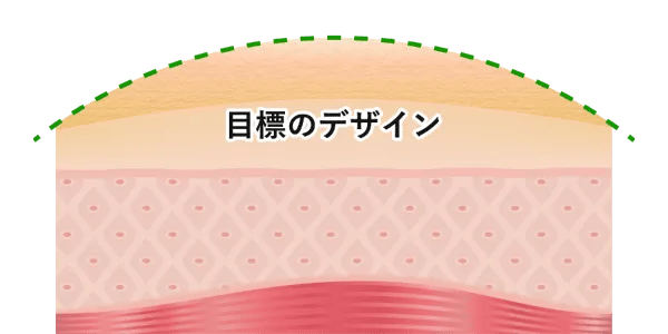 目標のデザイン