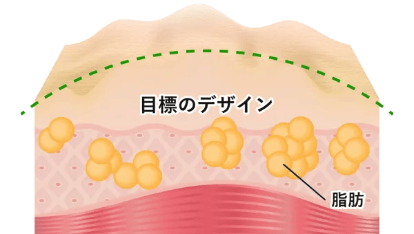 目標のデザイン 脂肪
